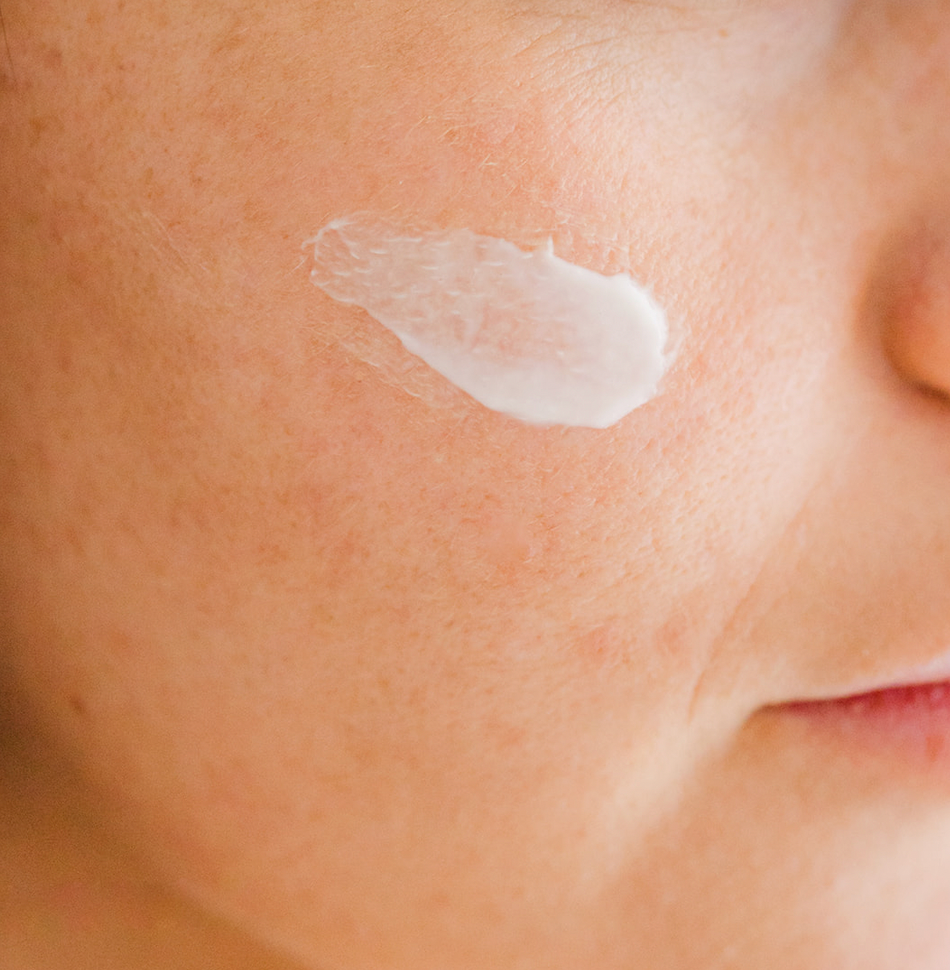 Summer Skin Tips for Acne Prone Skin: Why you should use noncomedogenic products.